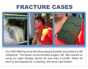 כיתה 4 אינפרא אדום 945nm 650nm 650nm כאב מלא גוף מלא כאב לייזר lumbar עמוד השדרה lt - Product Image 4