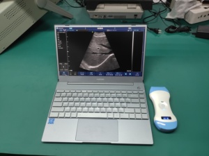 DMU40 Meilleur prix pour un scanner de détection par ultrasons à sonde Doppler couleur légère de nouvelle conception, trois-en-un, avec 128 éléments de matrice - Product Image 4