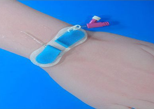 Perangkat fiksasi jarum pemasangan kateter Epidural, perangkat perbaikan mudah memperbaiki kateter medis medicos sonda - Product Image 4