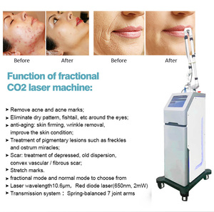 Dispositivo de Belleza 2025 Versión de Lujo, Tratamiento para el Acné con Dióxido de Carbono Indoloro de 1064nm, Rejuvenecimiento de la Piel, Cuidado Vaginal con CO2, para el Cuerpo en Casa - Product Image 6