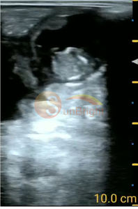 Sonda USB lineal rectal Proveedores de dispositivos médicos <span class=keywords><strong>Doppler</strong></span> a color Uso veterinario - Product Image 2