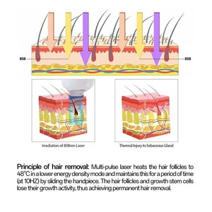 Máy <span class=keywords><strong>laser</strong></span> <span class=keywords><strong>diode</strong></span> cầm tay công suất cao 2000W mới năm 2025, sử dụng <span class=keywords><strong>diode</strong></span> Đức, 3 bước sóng <span class=keywords><strong>laser</strong></span>, thiết bị làm đẹp, triệt lông bằng <span class=keywords><strong>laser</strong></span> tại salon - Product Image 6