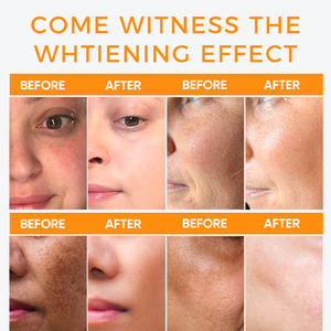 <span class=keywords><strong>Crema</strong></span> Facial Aclarante e Iluminadora de Papaya <span class=keywords><strong>Natural</strong></span> de Marca Privada con Piel Radiante y Humectante Facial - Product Image 6