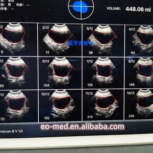 High Speed on Scan and Process (2s) Handheld Mini 4d Wireless Ultrasound Bladder Scanner B10 - Product Image 6