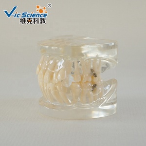 Prezzo di fabbrica Frasaco Typodont ortodontico dente dentale modello per la vendita denti ortodontico studente orale insegnamento del prodotto pratica