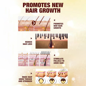 Nhãn Hiệu Riêng Biotin Hữu Cơ Dầu Gội Tăng Trưởng Tóc Và Điều Hòa Set Thảo Dược Tự Nhiên Dày Chống Rụng Tóc Dầu Gội - Product Image 5