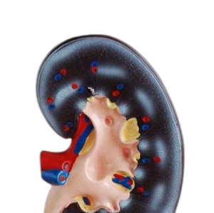 Modelo Anatómico de Riñón de 1 y 2 Partes para Demostración de Enfermedades, Herramienta de Enseñanza Médica, Modelo Médico - Product Image 4