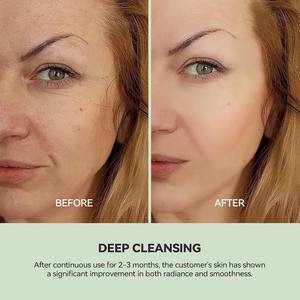 U-zona pulizia grigio <span class=keywords><strong>argilla</strong></span> profonda pulizia olio di controllo con acido ialuronico <span class=keywords><strong>argilla</strong></span> bianca per la rimozione punti neri rinfrescare la pelle - Product Image 6
