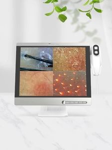 Máquina Analizadora de Cuero Cabelludo HD Multilingüe de Alta Calidad para el Análisis de Problemas Capilares - Product Image 5