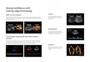 <span class=keywords><strong>Mindray</strong></span> Vetus 7 Exp Veterinaire Diagnostische Echografie <span class=keywords><strong>Machine</strong></span> Met Micro-Convexe C11-3s En Fase Sonde P8-2s - Product Image 3