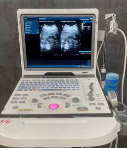 Système d'échographie vétérinaire portable Mindray DP-50 Expert avec échographe Mindray pour usage médical vétérinaire, certifié CE - Product Image 6