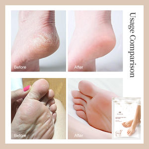 Lavanda Aloe <span class=keywords><strong>pies</strong></span> exfoliante pie <span class=keywords><strong>crema</strong></span> máscara piel Peeling piel muerta <span class=keywords><strong>pies</strong></span> máscara adultos cuidado de los <span class=keywords><strong>pies</strong></span> productos 3 años OEM/ODM 20 pares - Product Image 6
