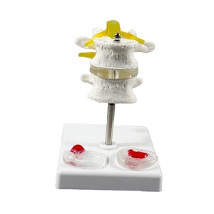 Modelo Anatómico de Disco Intervertebral Lumbar Humano Fabricado por MAXCARE, Modelo de Esqueleto de Ciencia Médica de ABS/PVC - Product Image 1