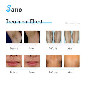 1200w 3 vagues dioden laser 755nm 808nm 1064nm Diode Laser Machine d'<span class=keywords><strong>épilation</strong></span> permanente - Product Image 6