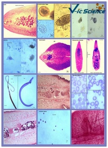 Microscopio de vidrio de Parasitología de ciencia médica, portaobjetos preparados, portaobjetos de alta calidad para estudios de parasitología - Product Image 3