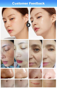 Máquina Profesional Multifuncional 15 en 1 de Microdermoabrasión con Chorro de Agua y Oxígeno - Product Image 6