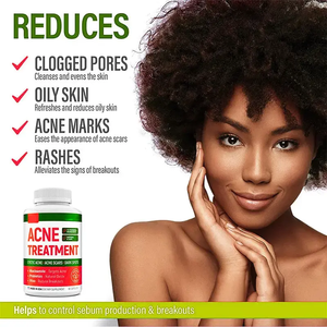 Oem nhãn hiệu riêng mụn trứng cá vitamin và khoáng chất da thanh toán bù trừ bổ sung cho sức khỏe hệ thống miễn dịch mụn trứng cá viên nang - Product Image 5