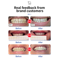 Gel blanchissant pour les dents Luxsmile, recharge personnalisée, carbamide, blanchiment, hydrogène, sans peroxyde, stylo blanchissant pour les dents, organique