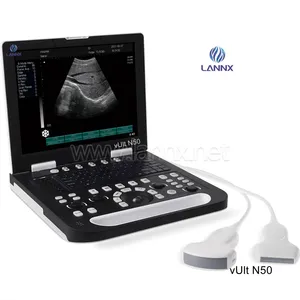LANNX VUlt N50 Diskon Besar Mesin Pemindai <span class=keywords><strong>Ultrasound</strong></span> Hewan Portabel untuk Hewan Kuda Sapi Hewan Hewan <span class=keywords><strong>Ultrasound</strong></span> dengan Prode - Product Image 1