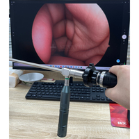 Caméra endoscopique médicale USB SY-P031HD3 1080P HD pour ORL