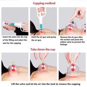 مجموعة متنوعة من أكواب الحجامة المستخدمة على نطاق واسع لتكبير الثدي للبيع من المصنع، مسدس يدوي للتحكم في الحجامة، مضخة حجامة التفريغ - Product Image 4