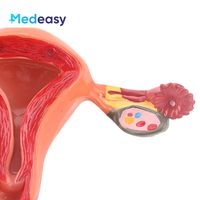 Modelo de Útero Femenino Desmontable Medeasy, Modelo de Vagina, Modelo Anatómico de Útero y Ovario Humano, Modelos de Ciencias Médicas