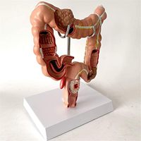 Modèle de maladie du côlon et du rectum humain KyrenMed, modèle pathologique de l'intestin grêle