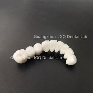 Laboratoire dentaire professionnel fabrication Pfz zircone couronnes dents molaires esthétique <span class=keywords><strong>prix</strong></span> abordable - Product Image 4