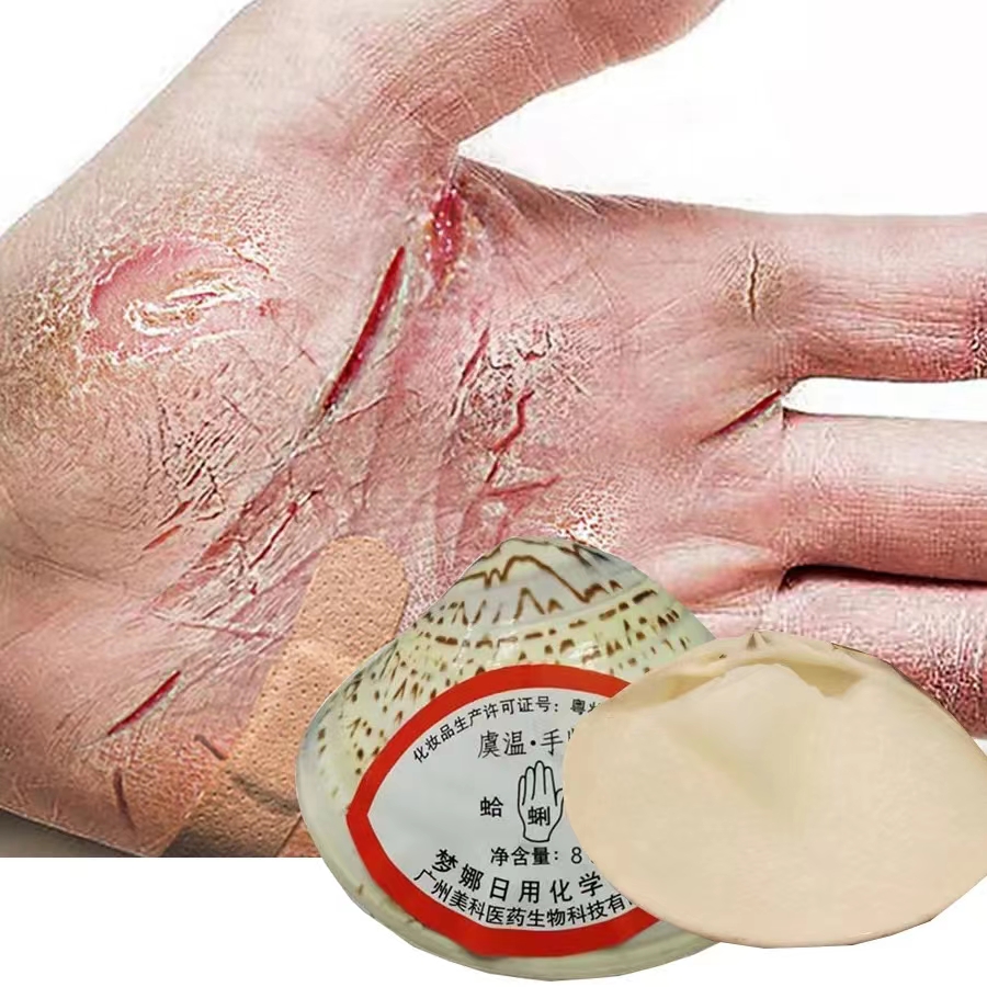 Traditional Chinese Clam Oil Anti-Drying Crack Foot Cream Heel Cracked Repair Cream Removal Dead Skin Hand Feet Care Hand Oil