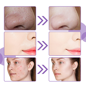 Private Label Skin Care Retinol & Vitamin C Herbal Anti-Aging Deep <b>Cleansing</b> <b>Facial</b> Bubble Mask for All Skin Types - Product Image 4