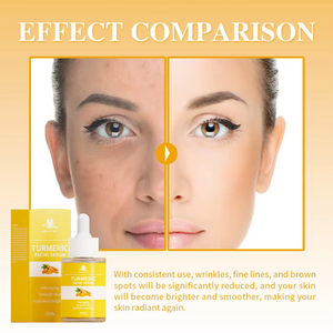 Toptan doğal C vitamini aydınlatma anti-kırışıklık akne kaldırma koyu nokta Glow nemlendirici beyazlatma yüz zerdeçal Serum - Product Image 5