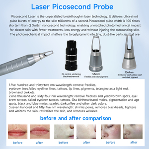เครื่องกำจัดขน 2 in 1 รุ่น 808nm สำหรับใช้ในบ้าน ยี่ห้อ Poland Stock พร้อมเครื่องลบรอยสัก Picosecond มีสินค้าในสต็อก EU และเม็กซิโก ไม่มีค่าธรรมเนียมอื่นๆ - Product Image 6