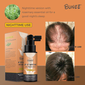 Muestras gratis agua de arroz crecimiento extremo rápido biotina crecimiento del cabello suero <span class=keywords><strong>spray</strong></span> para bordes rotos y cabello - Product Image 6