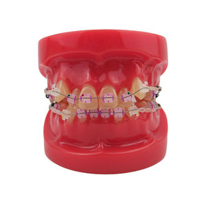 Modelo de Demostración de Ortodoncia Dental con 24 Piezas de Brackets de Cerámica - Product Image 1