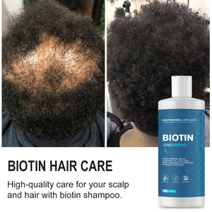 迷迭香薄荷强化洗发水注入生物素，清洁并有助于强化脆弱的头发 - Product Image 4