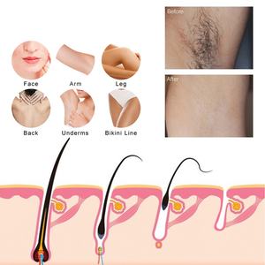 Mousse dépilatoire douce au miel doré 60 ml la plus vendue pour le corps - Product Image 4