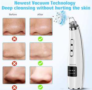 USB-C Vacuum Blackhead Remover Handheld Electric Suction Facial Nose <b>Pore</b> <b>Cleaner</b> for Home Use - Product Image 5