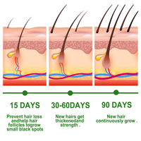 XM Label pribadi minyak esensial Rosemary canggih OEM ODM meningkatkan sirkulasi darah untuk pertumbuhan rambut dan perawatan kulit produk rambut