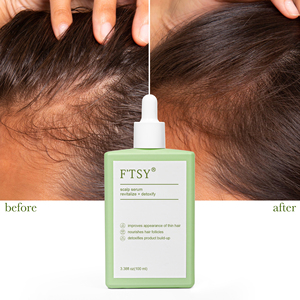 Formula personalizzata <span class=keywords><strong>olio</strong></span> naturale crescita dei capelli più spessa capelli più forte pelle radianza nutrimento <span class=keywords><strong>olio</strong></span> essenziale siero - Product Image 6