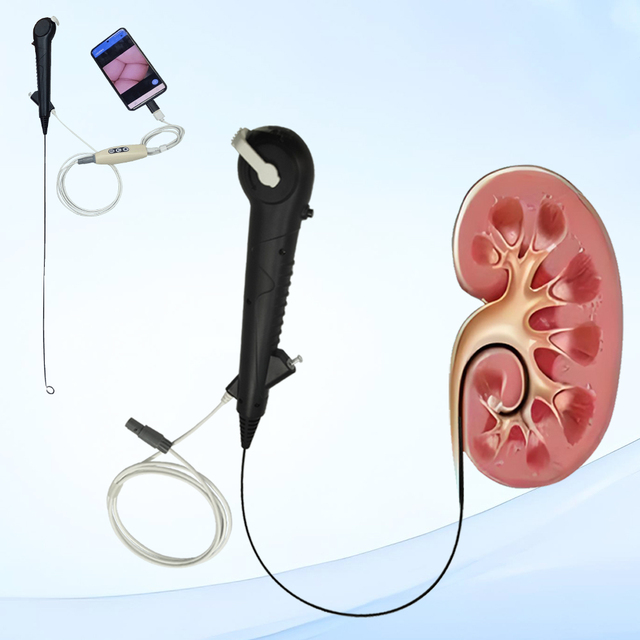 7.5FR ,8.5FR Disposable Medical Digital Surgical Instrument Electric Flexible Ureteroscope for Hospitals Image & Camera Sensors