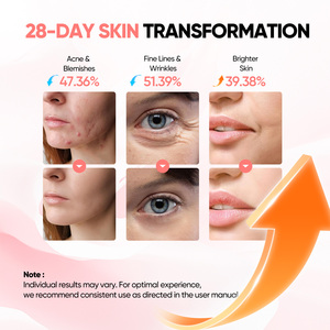 <span class=keywords><strong>7</strong></span> Màu Sắc <span class=keywords><strong>LED</strong></span> Mặt Nạ Trên Khuôn Mặt <span class=keywords><strong>Photon</strong></span> Therapy-3D Silicone Hàm Bảo Vệ Mặt Nạ Loại Bỏ Nếp Nhăn Màu Đỏ/Màu Xanh/Màu Xanh Lá Cây/Đèn Hồng Ngoại Cho Nhà - Product Image 4