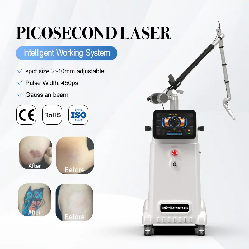 Nubway neuestes Design 1-10Hz einstellbarer Pikosekunden-Q-Switch und Yag-Laser-Tattoo entfernungs geräte für die Klinik