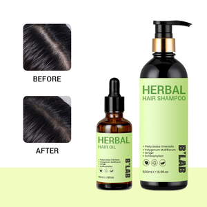 Shampooing et revitalisant pour la croissance des cheveux à base de plantes réparation au gingembre botanique traitement Anti-perte de cheveux huile plus épaisse ensemble de soins pour la repousse des cheveux - Product Image 1