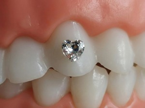 Gioielli Dentali a Forma di Cuore in Cristallo - Gemme Dentali Premium per un <span class=keywords><strong>Sorriso</strong></span> Scintillante, Gioielli in <span class=keywords><strong>Stile</strong></span> Hip Hop Punk - Product Image 3