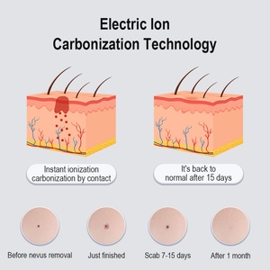Nuevo Dispositivo de Belleza Portátil con Carga USB, Pantalla LCD, para Eliminar Verrugas, Lunares Faciales y Corporales - Product Image 3