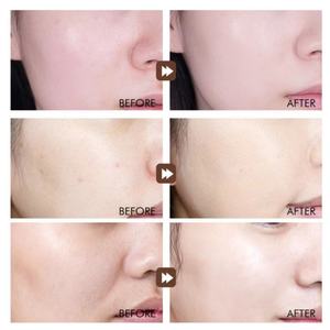 Mascarillas Faciales Blanqueadoras para el Cuidado de la Piel, Marca Privada Personalizada, Venta al por Mayor, Belleza Coreana, Mascarilla Facial Hidratante de Frutas - Product Image 3