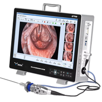 Endoscope ORL portable IKEDA YKD-9122H avec double commande d'opération pour laparoscopie et hystéroscopie ORL