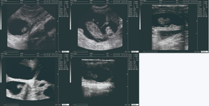 Sistema de diagnóstico por ultrassom digital completo portátil para uso em animais de estimação, instrumento veterinário portátil de baixo preço - Product Image 5