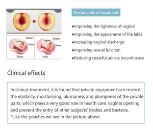 Autres équipements de salon de beauté - Thermi Aesthetics - Machine de rajeunissement vaginal par radiofréquence thermique RF - Serrage vaginal - Product Image 4