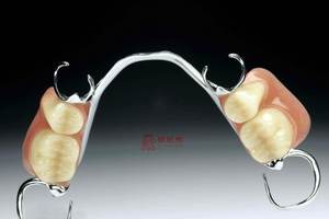 Prothèses dentaires amovibles avec cadre métallique imprimé <span class=keywords><strong>en</strong></span> 3D par laser, fabriquées <span class=keywords><strong>en</strong></span> Chine, laboratoire dentaire, <span class=keywords><strong>prix</strong></span> d'usine - Product Image 6